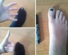 funny-pictures-of-color-toe-black-hole-in-sock-life-hack-370x297.jpg