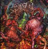 EPICARDIECTOMY 2012.jpg